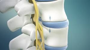 Gonstead chiropractic spinal adjustment
