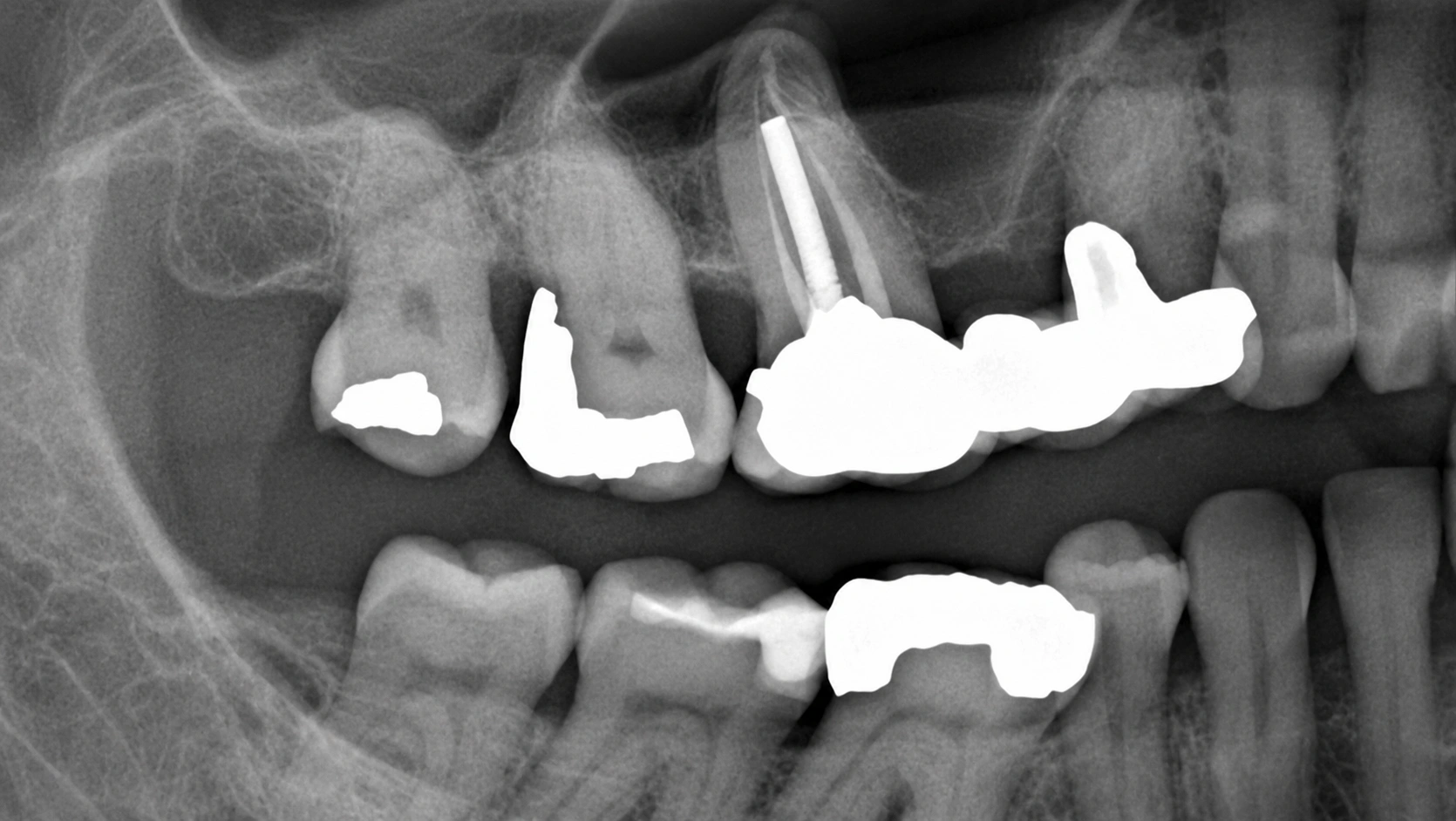 Diagnosis and planning module image