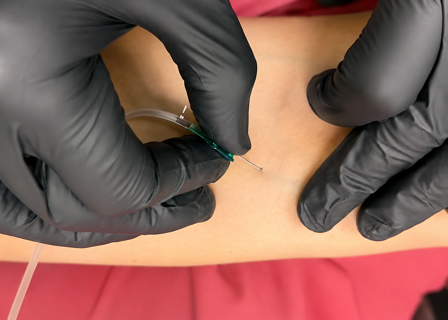 Platelet-rich fibrin module image