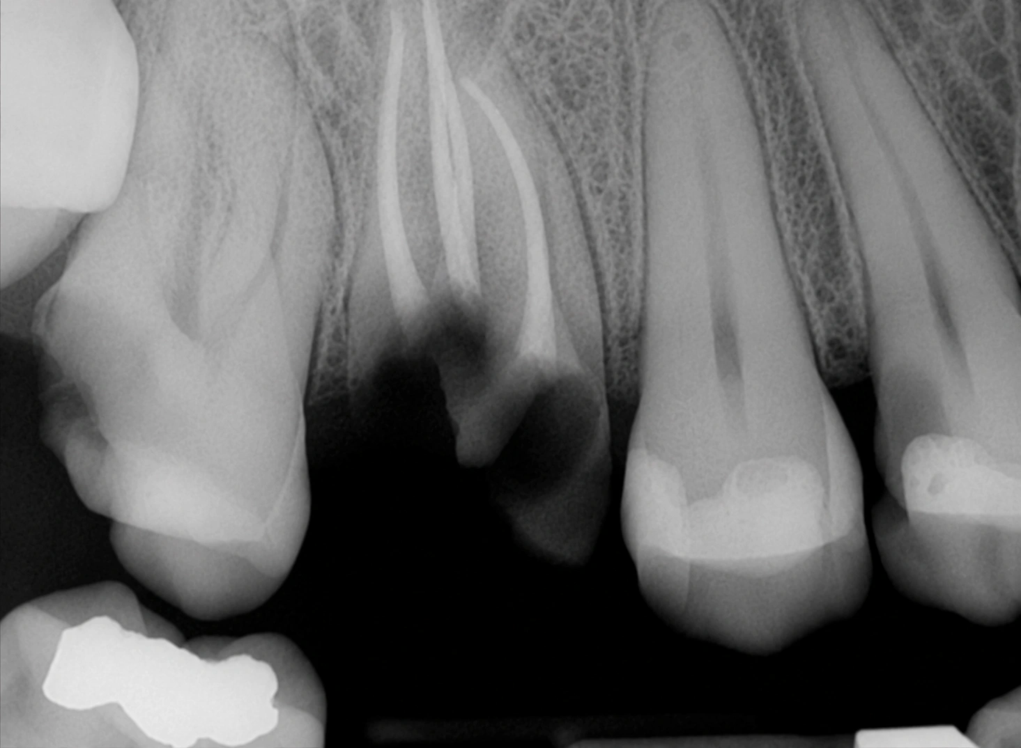 Surgical extraction case studies module image