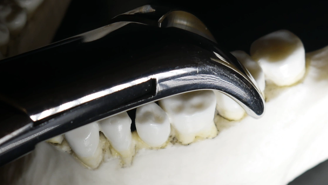 Extracting specific teeth module image