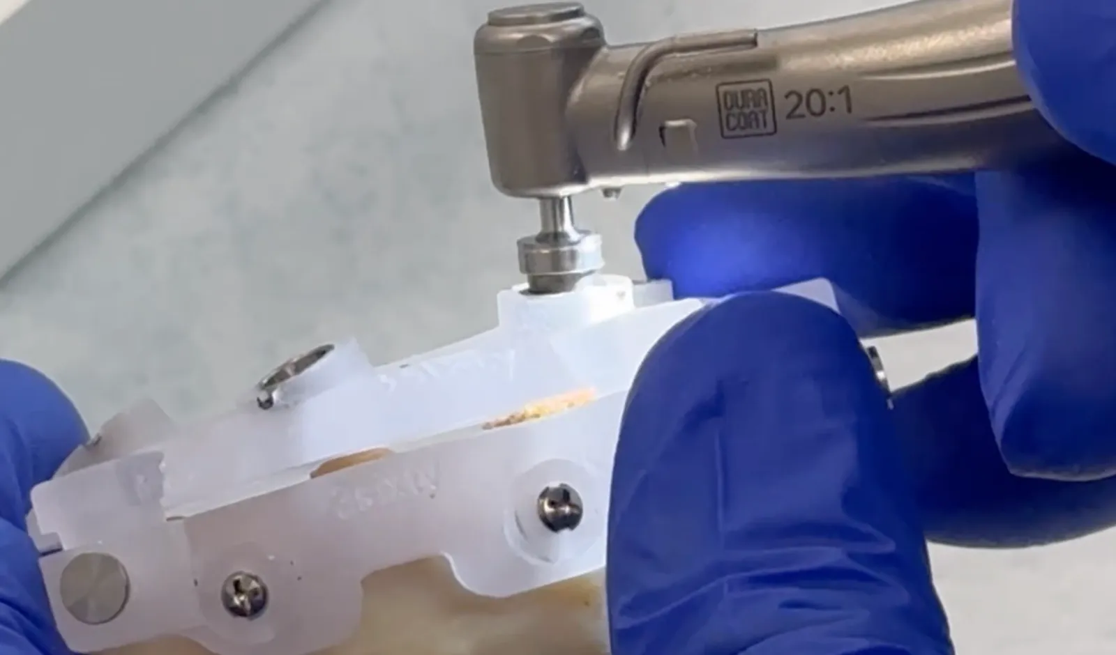 A gloved dentist drilling an implant site through a surgical guide on a model with a contra-angle handpiece