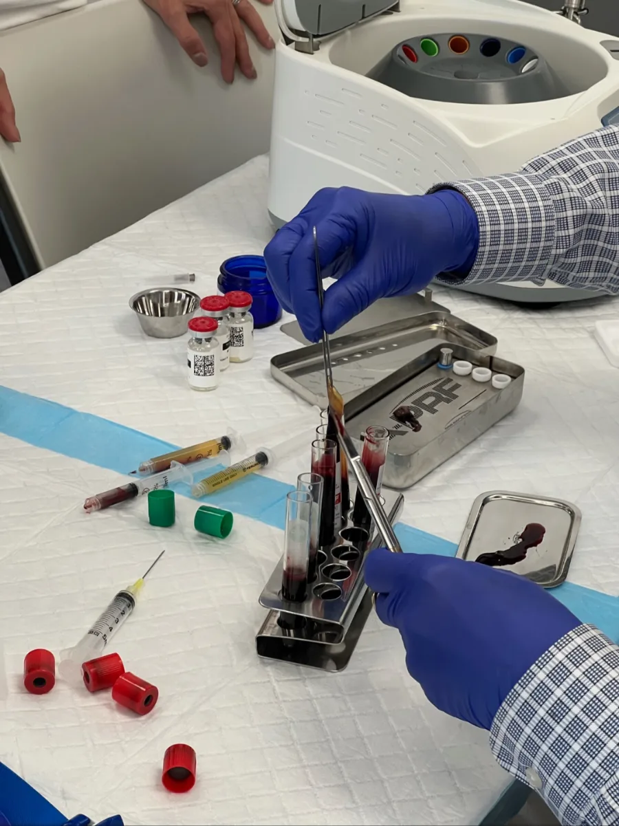 Gloved hands preparing PRF tubes at a workstation, with blood collection tubes, a tube rack and a centrifuge