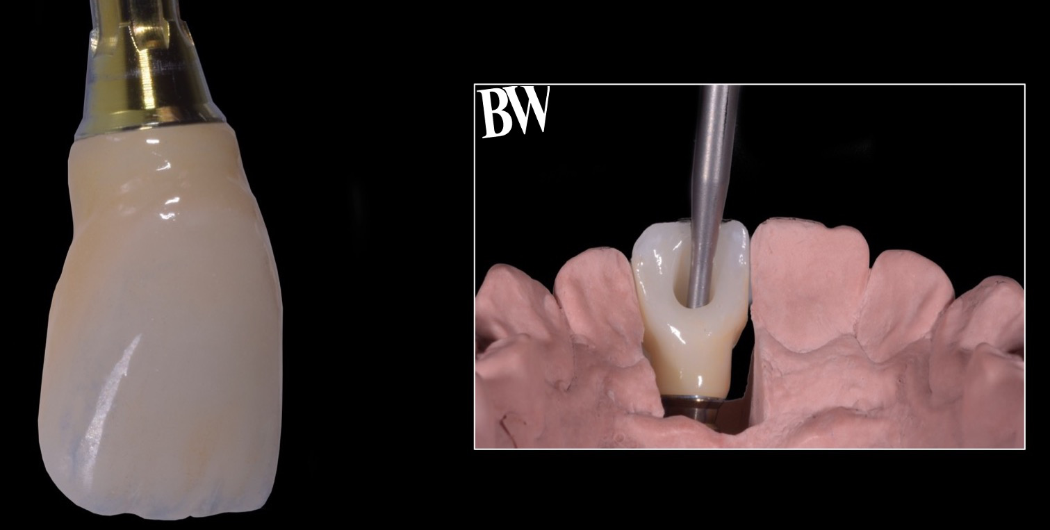 Implant Temporization Workshop — hands-on case work