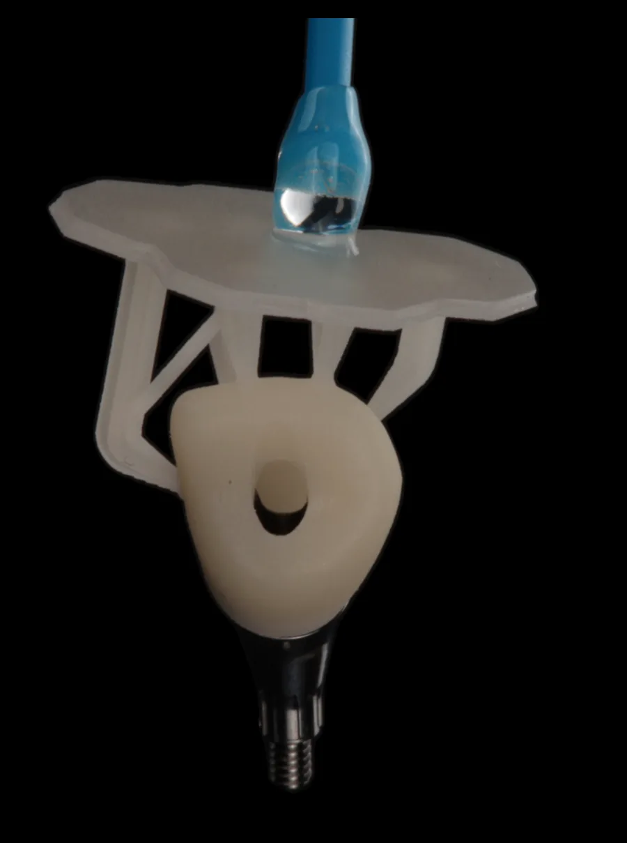 A custom implant provisional on its implant connection, held in a positioning jig