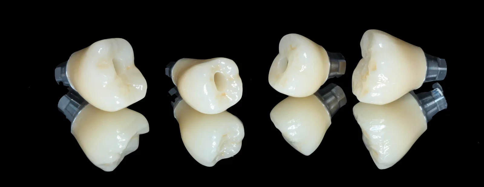Four screw-retained implant crowns on their implant connections, shown from the occlusal and side views