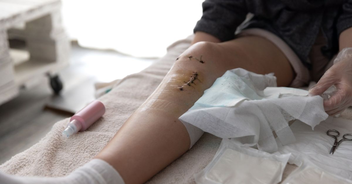 Skier showing common knee injury