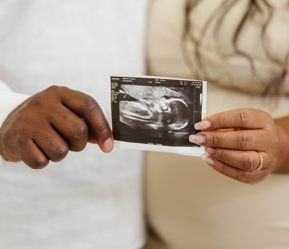 Hands holding an ultrasound photo