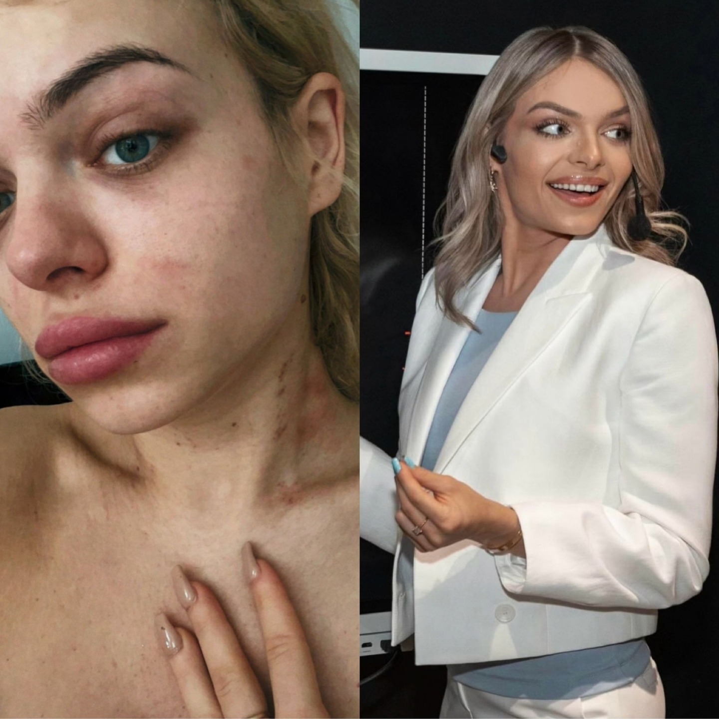 Gabriella Melrose transformation journey