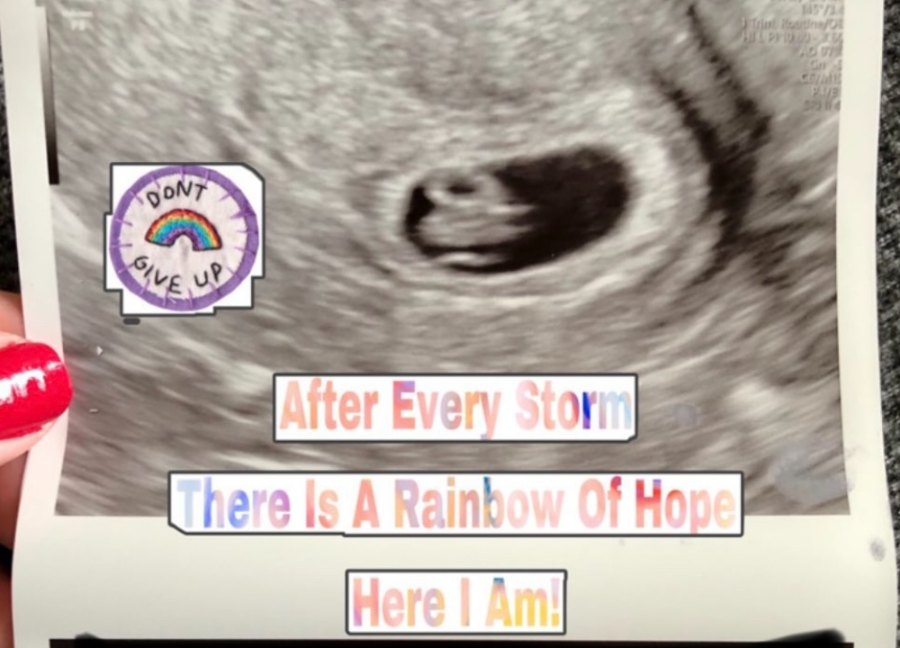 A rainbow baby ultrasound: after every storm there is a rainbow of hope