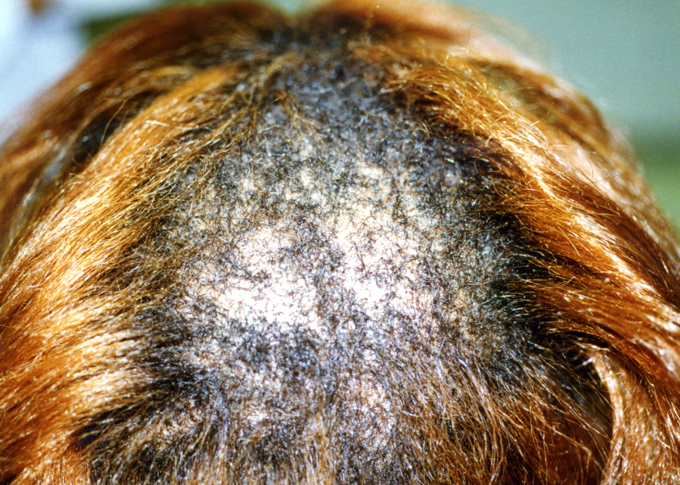 The image shown to the stylist during their conversation
