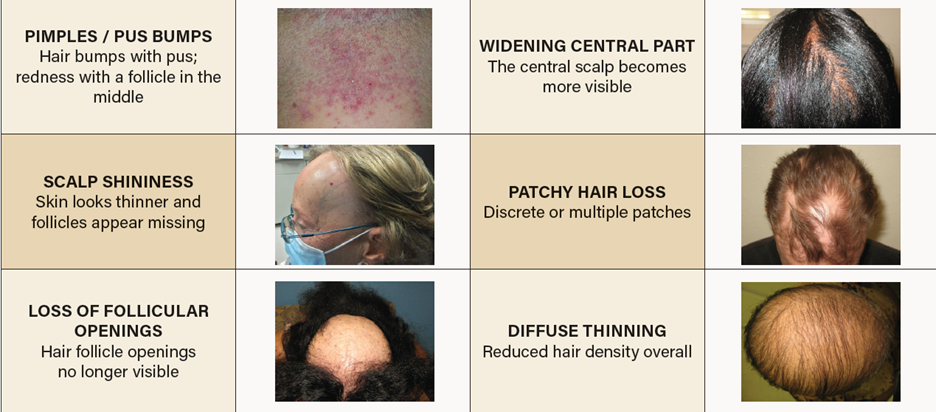 Examples of hair and scalp changes a stylist might encounter