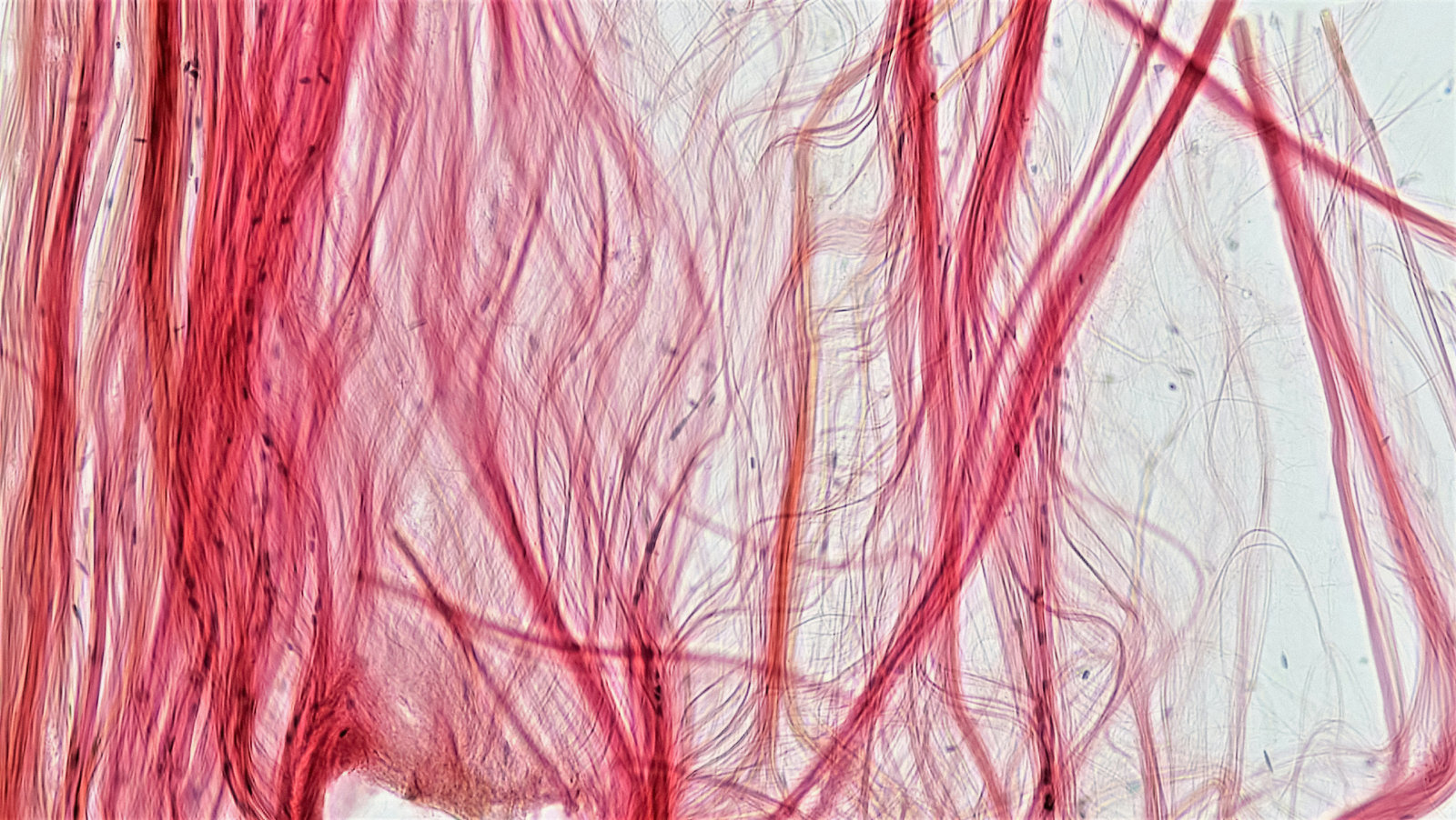 Microscopic image showing fibrous tissue strands in pink and red on a white background. No text visible, abstract and detailed.