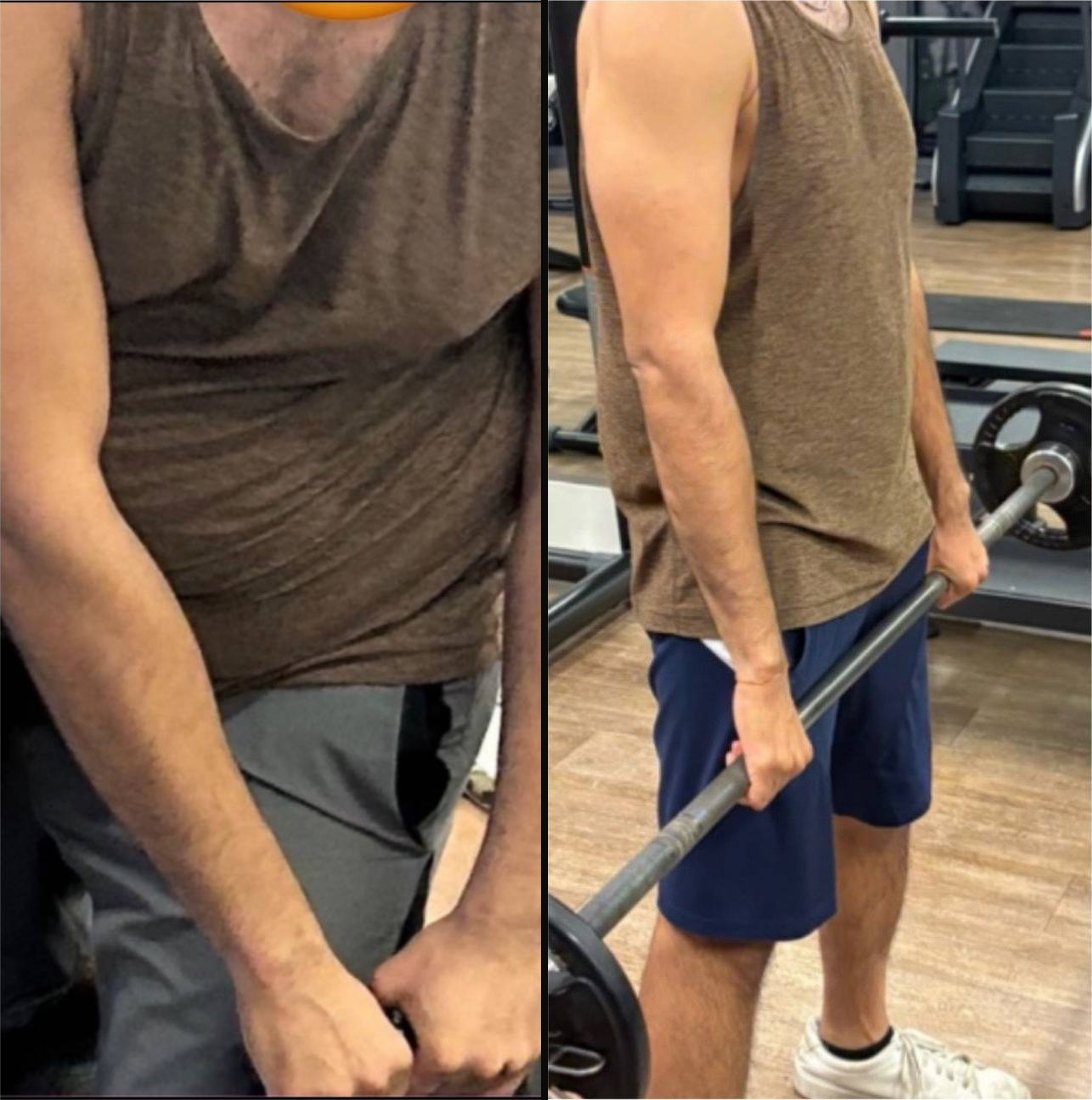 Sujay before and after
