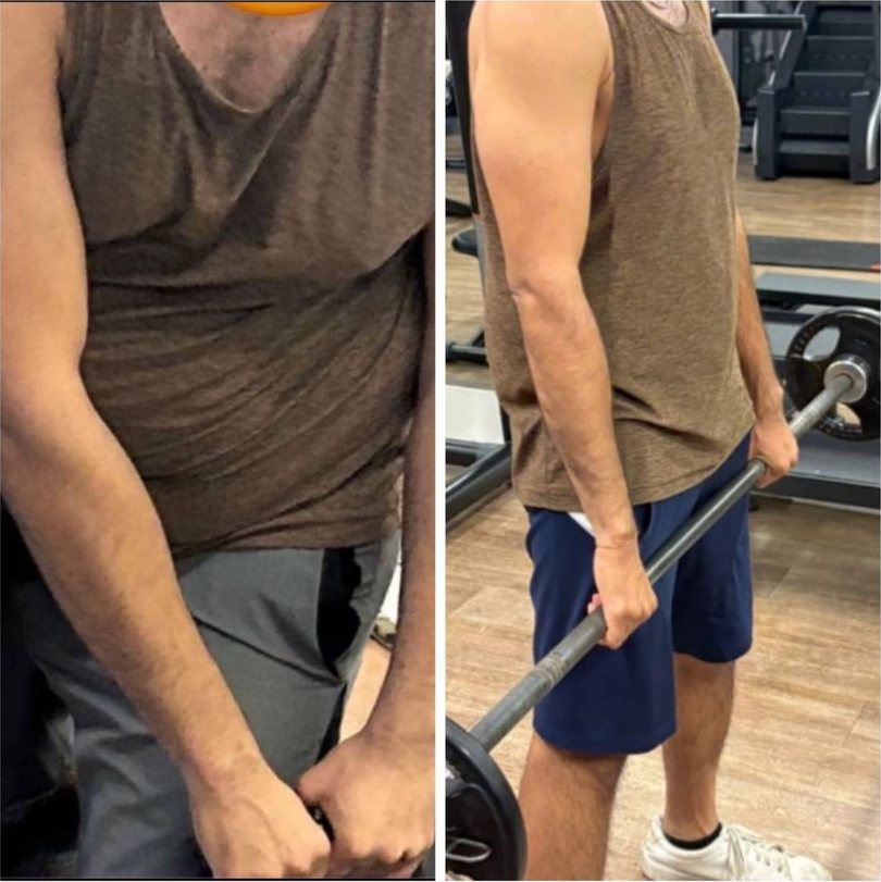 Sujay before and after