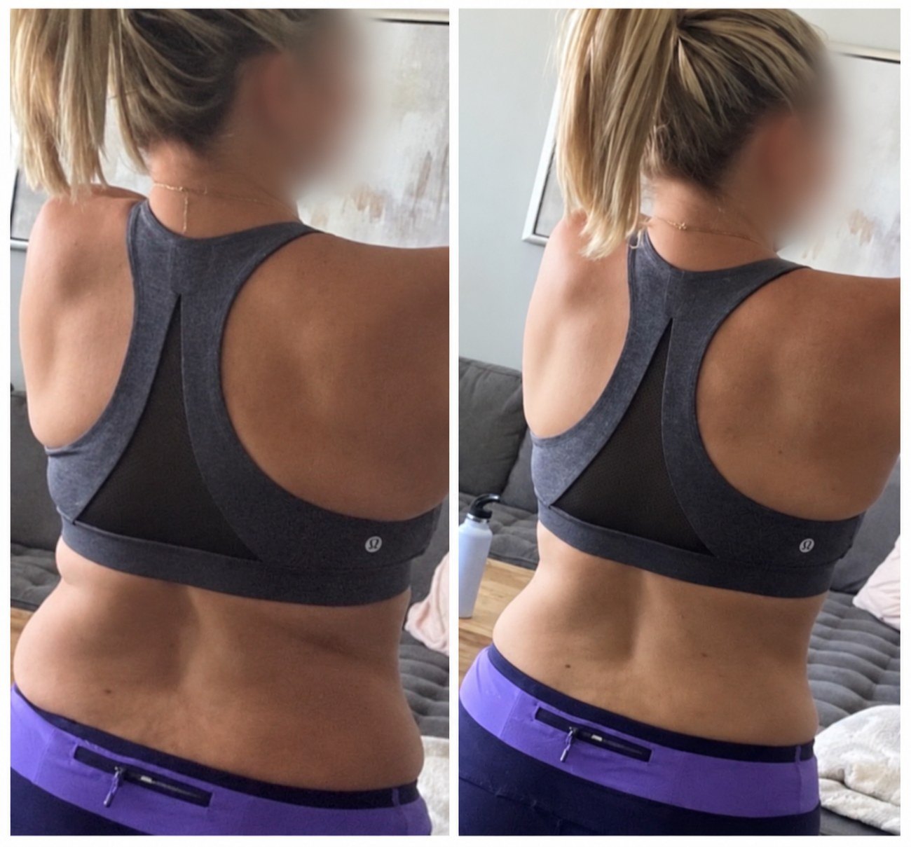 Lauren L before and after