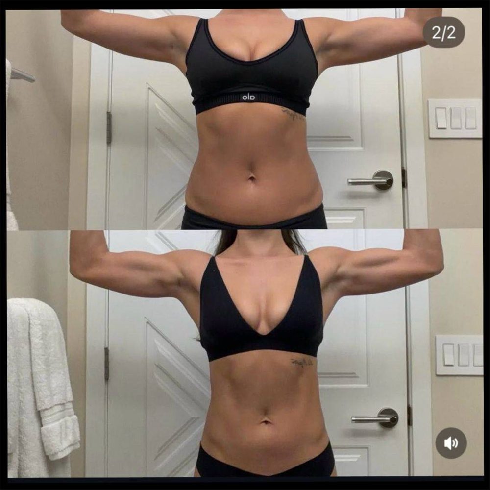Ev before and after