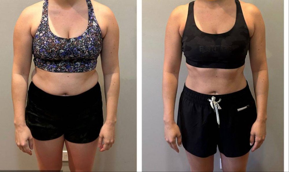 Lorna P. before and after