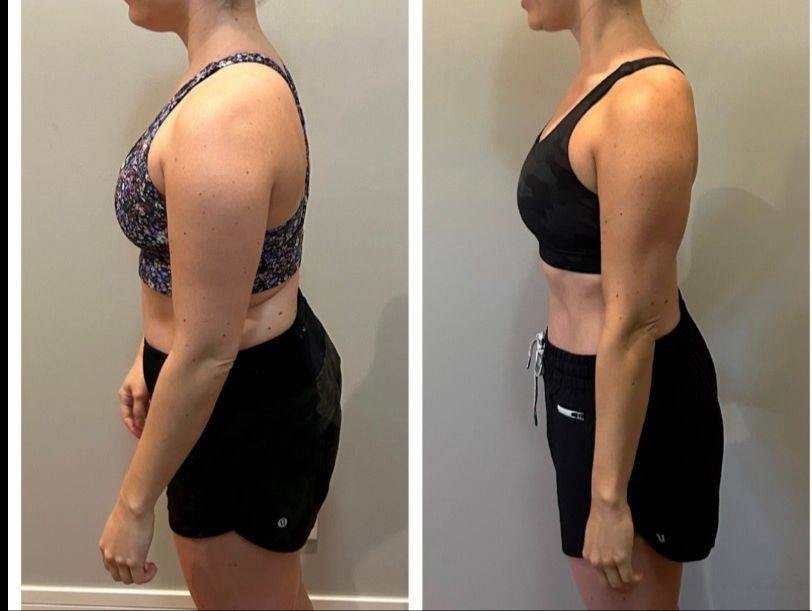 Lorna P before and after
