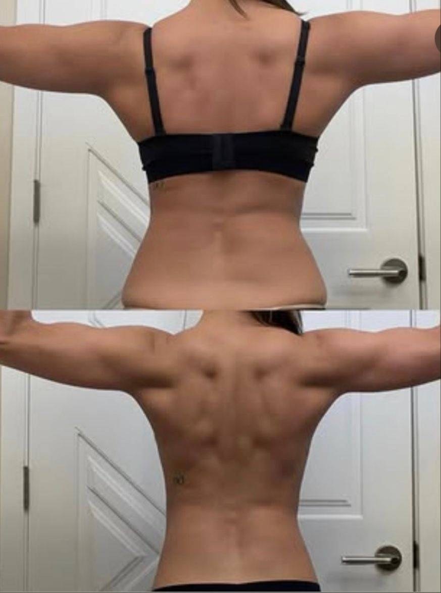 Ev before and after