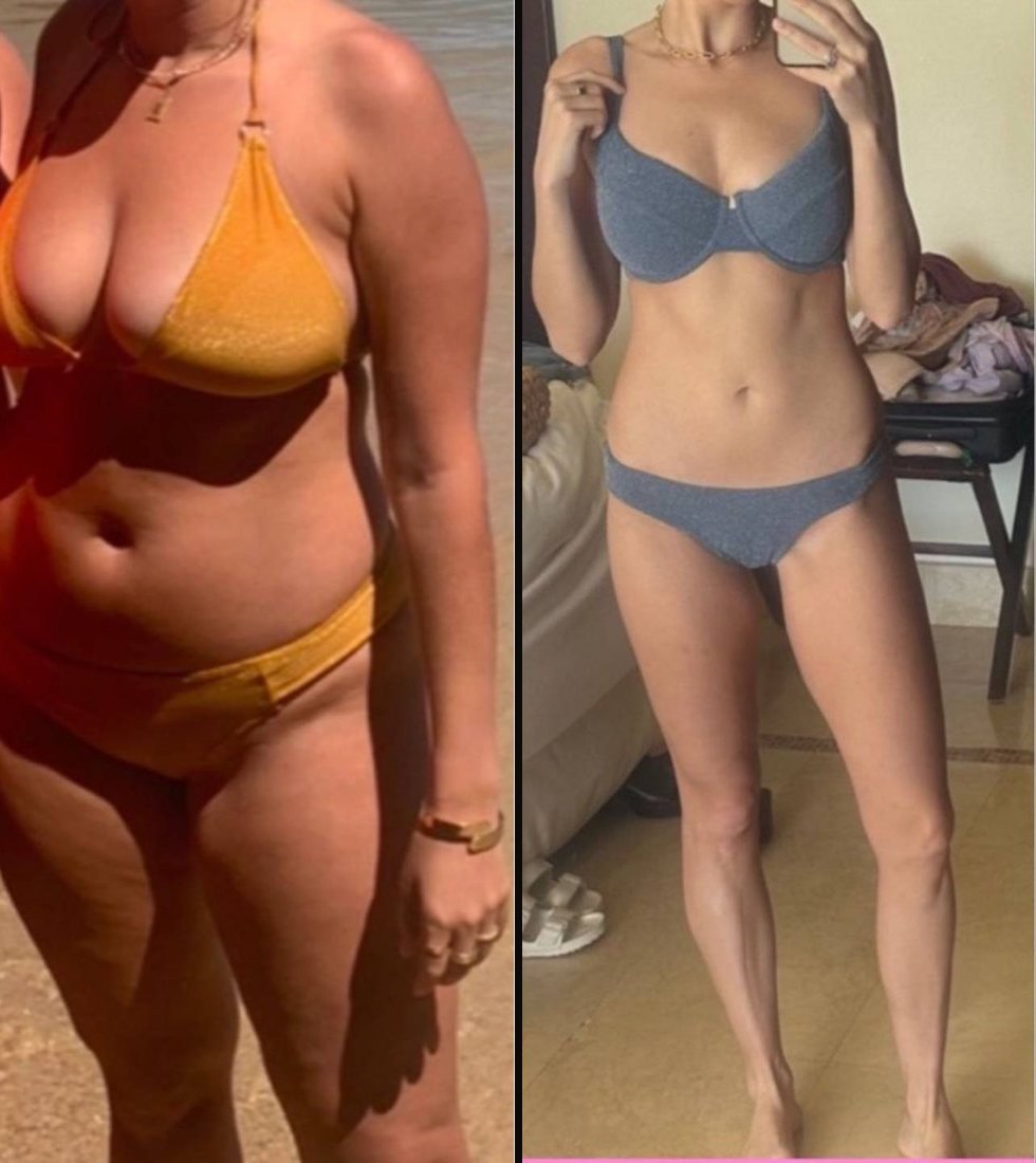 Amanda before and after