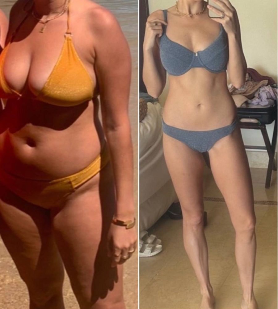Amanda before and after