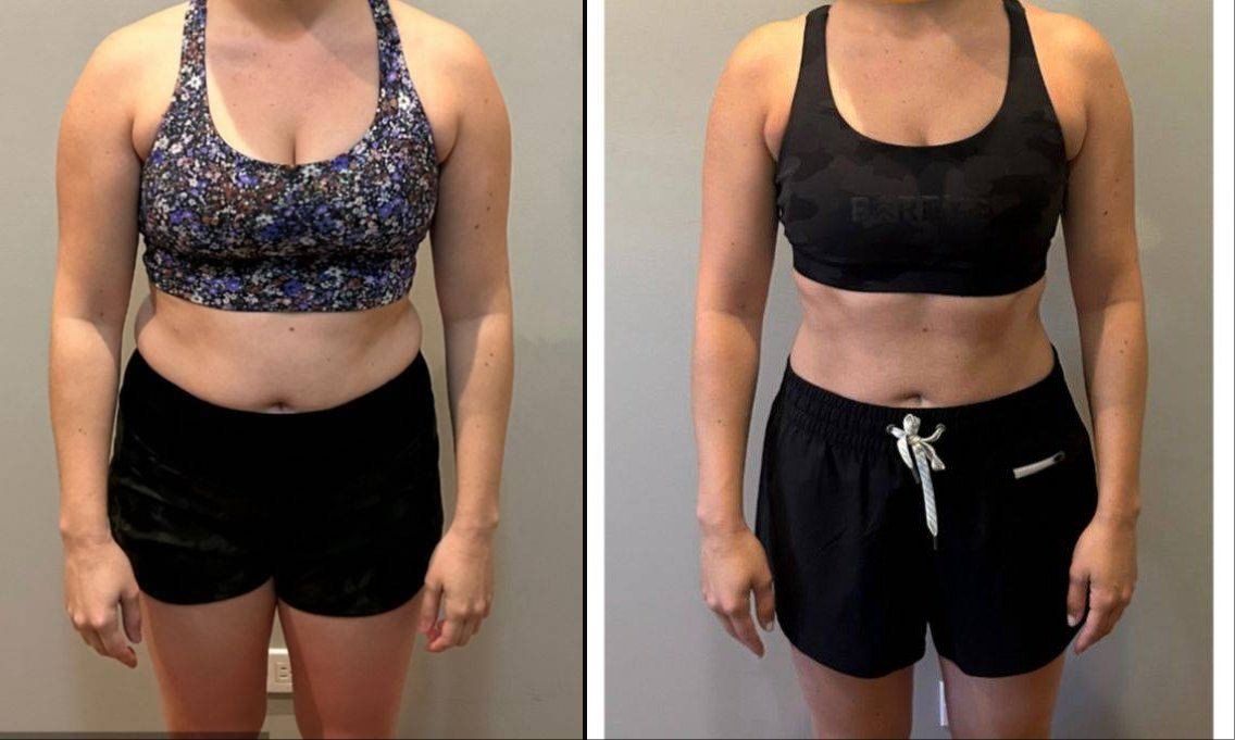 Lorna P before and after