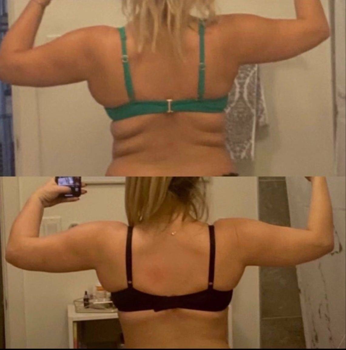Regi before and after