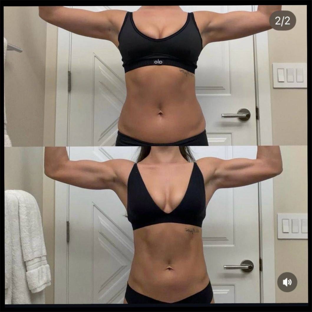 Ev before and after