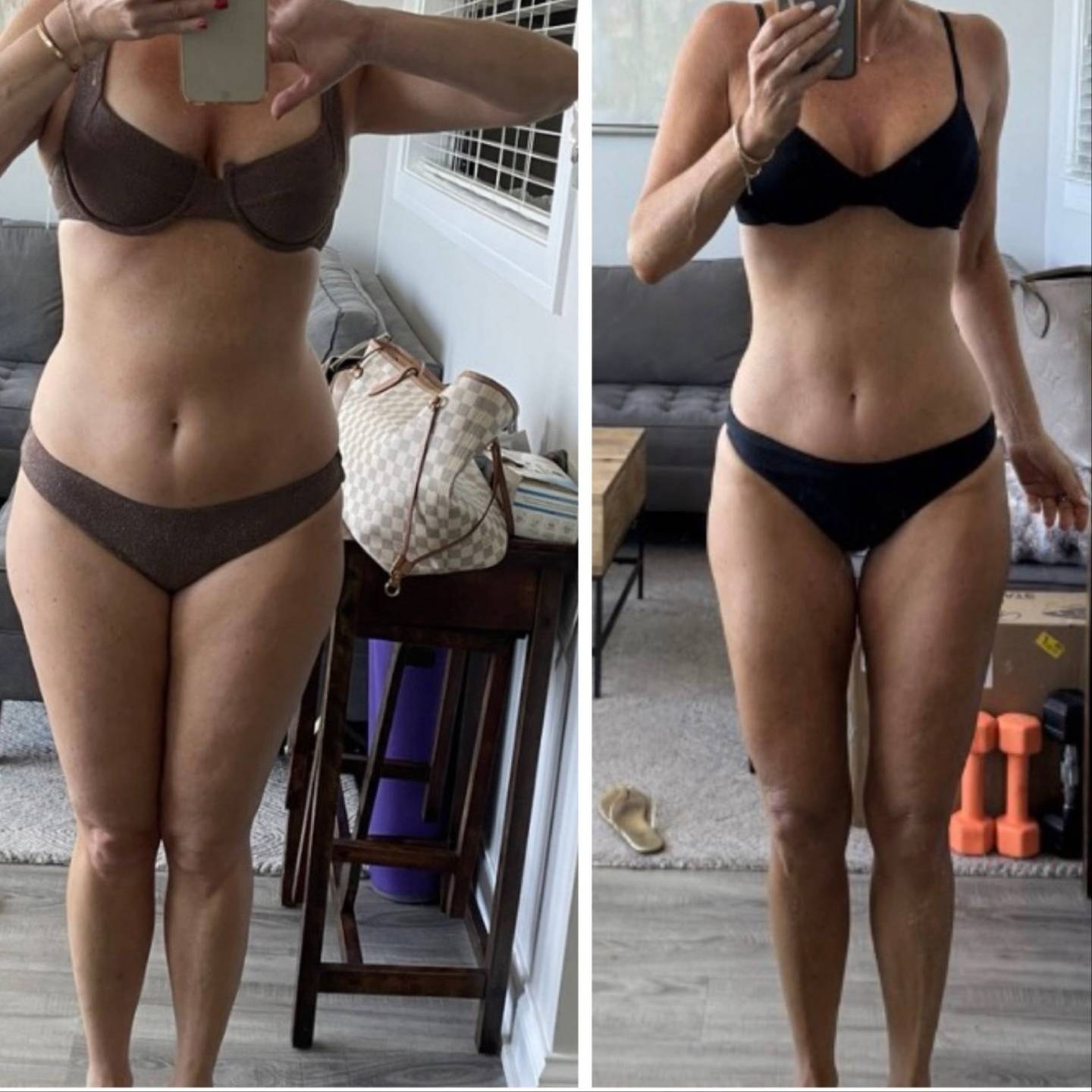 Lauren L before and after