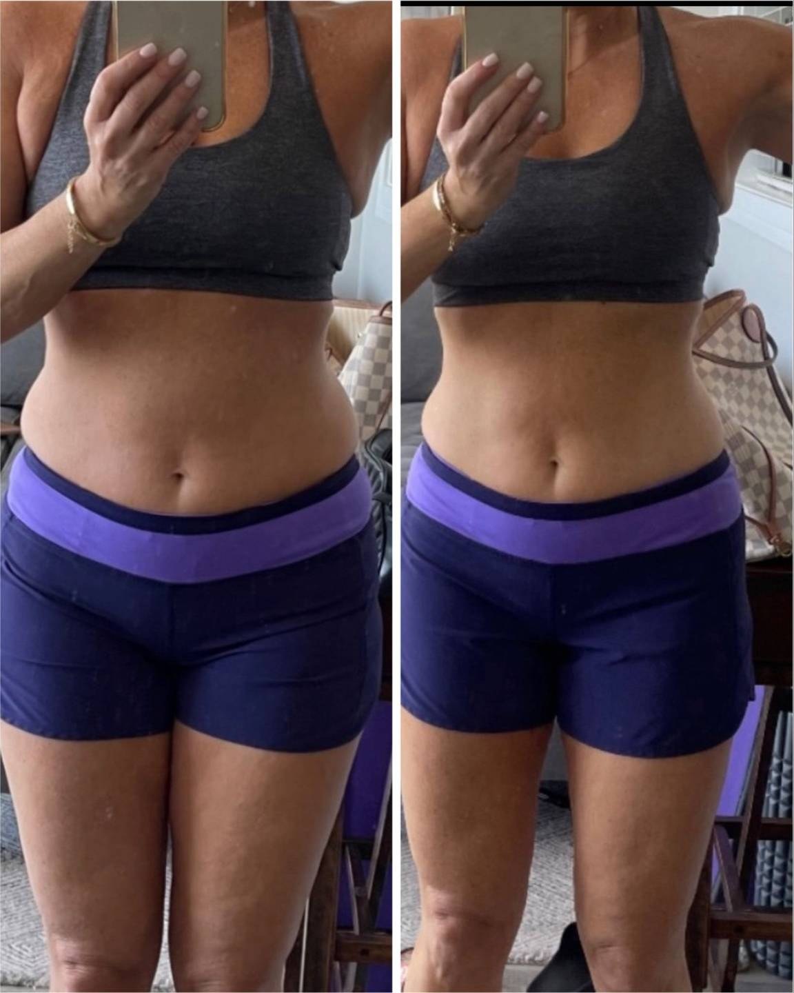 Lauren L before and after