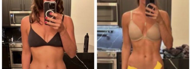 Alaina before and after
