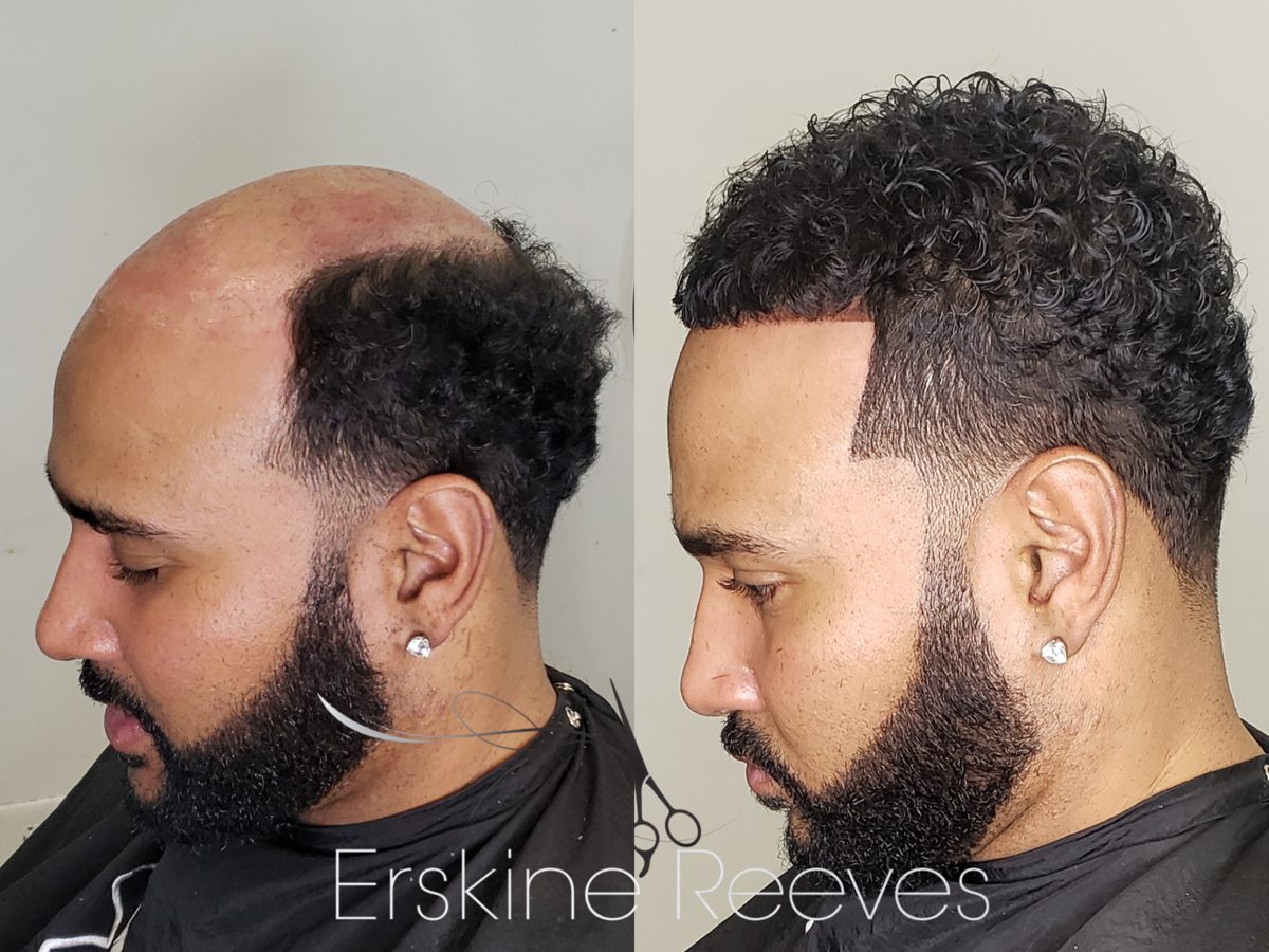 ManWeave before and after transformation by Erskine Reeves