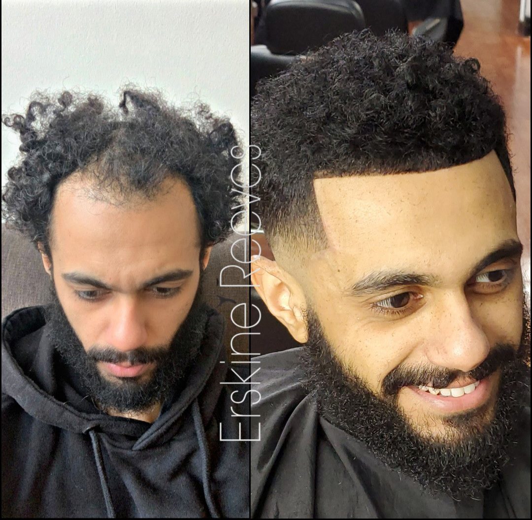 ManWeave before and after transformation by Erskine Reeves