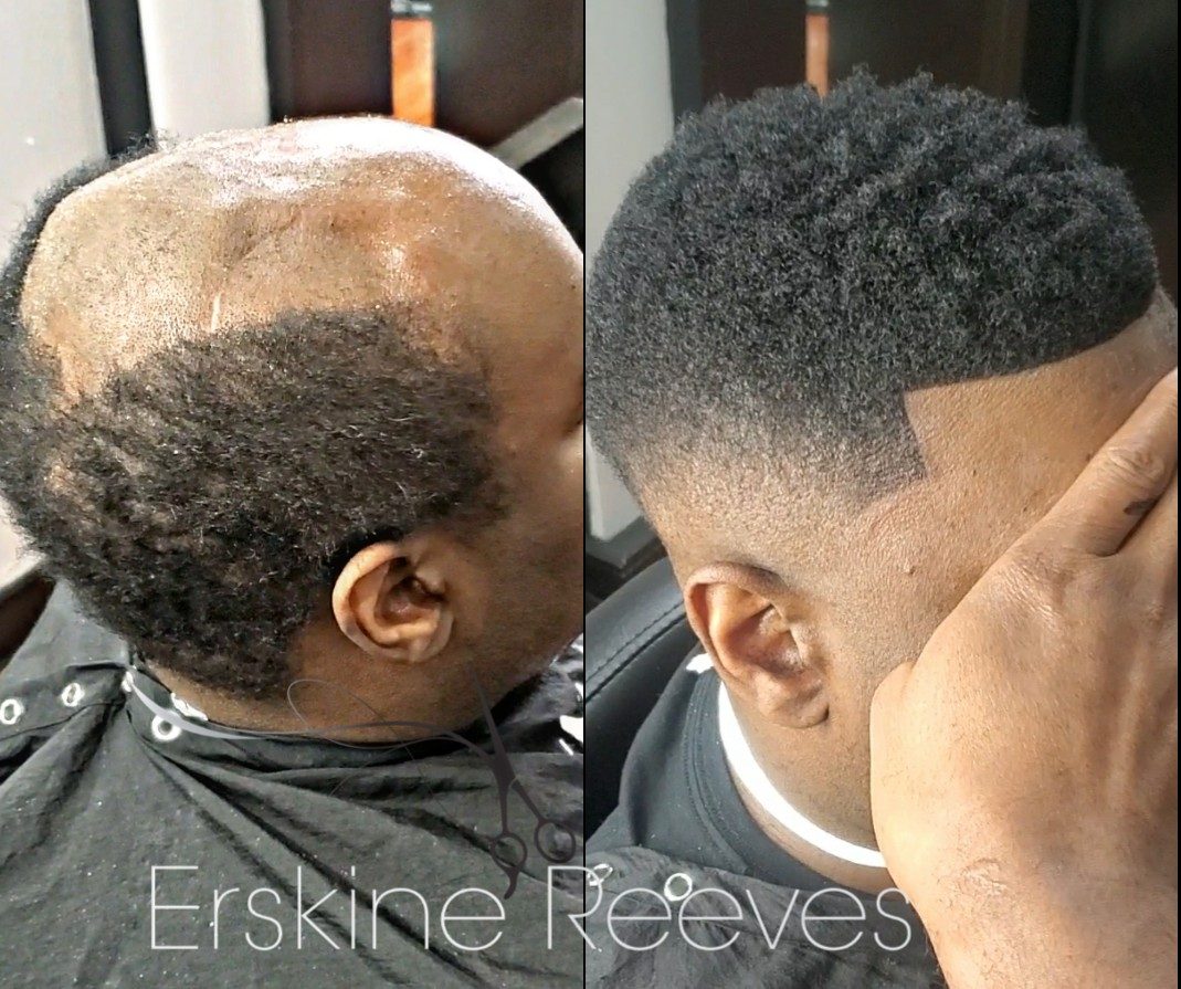 ManWeave before and after transformation by Erskine Reeves